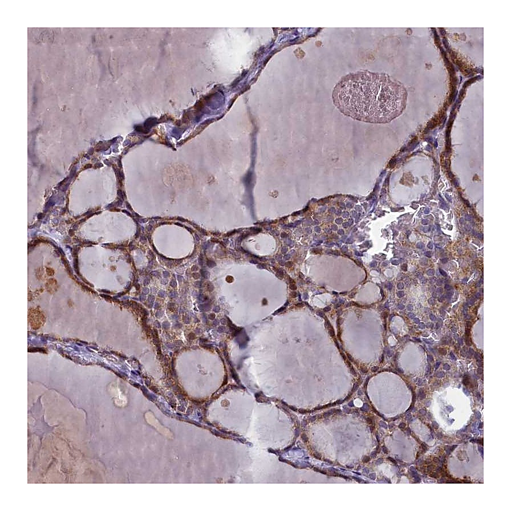 Atlas Antibodies Anti-ARL15 Antibody