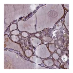 Atlas Antibodies Anti-ARL15 Antibody
