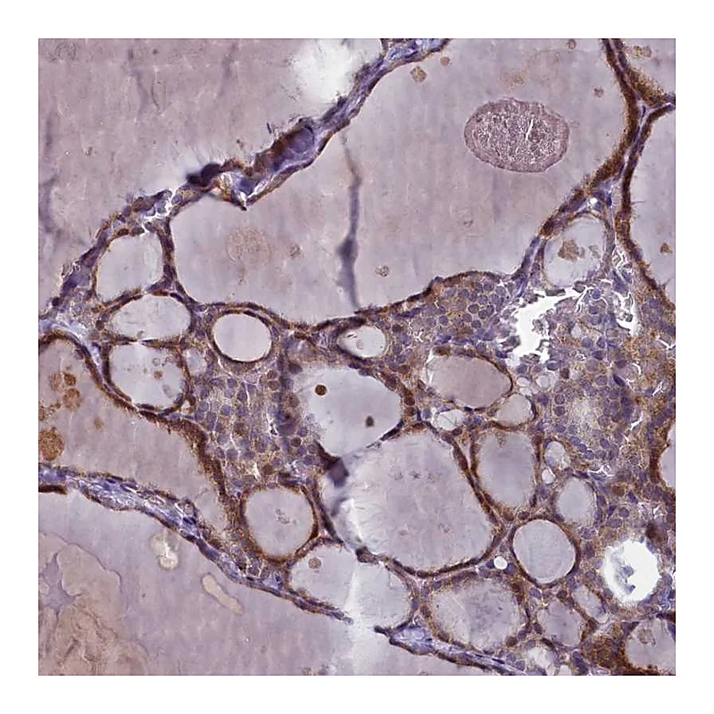 Atlas Antibodies Anti-ARL15 Antibody