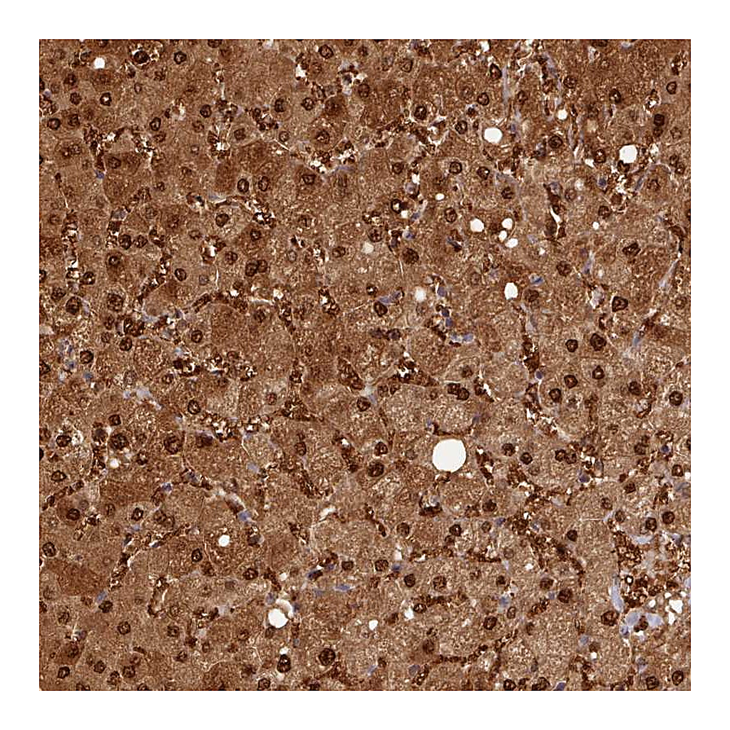 Atlas Antibodies Anti-ARL17A Antibody