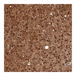 Atlas Antibodies Anti-ARL17A Antibody