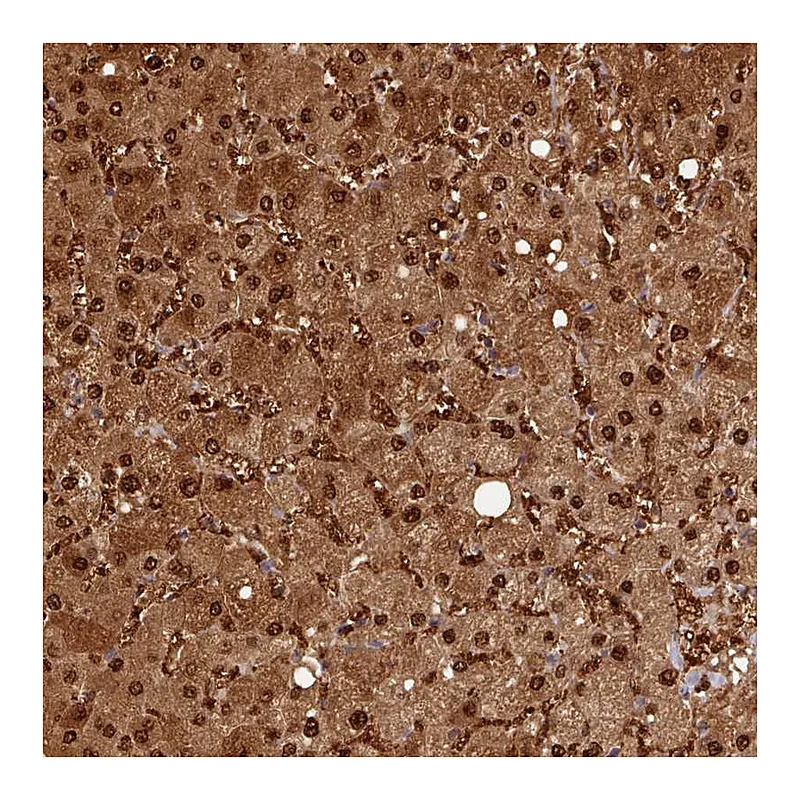 Atlas Antibodies Anti-ARL17A Antibody