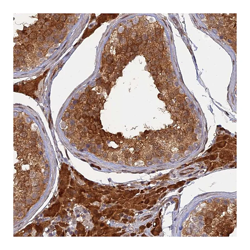 Atlas Antibodies Anti-ARL2BP Antibody