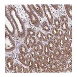 Atlas Antibodies Anti-ARL2BP Antibody