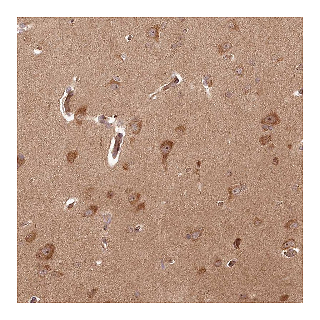 Atlas Antibodies Anti-ARL3 Antibody