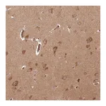 Atlas Antibodies Anti-ARL3 Antibody