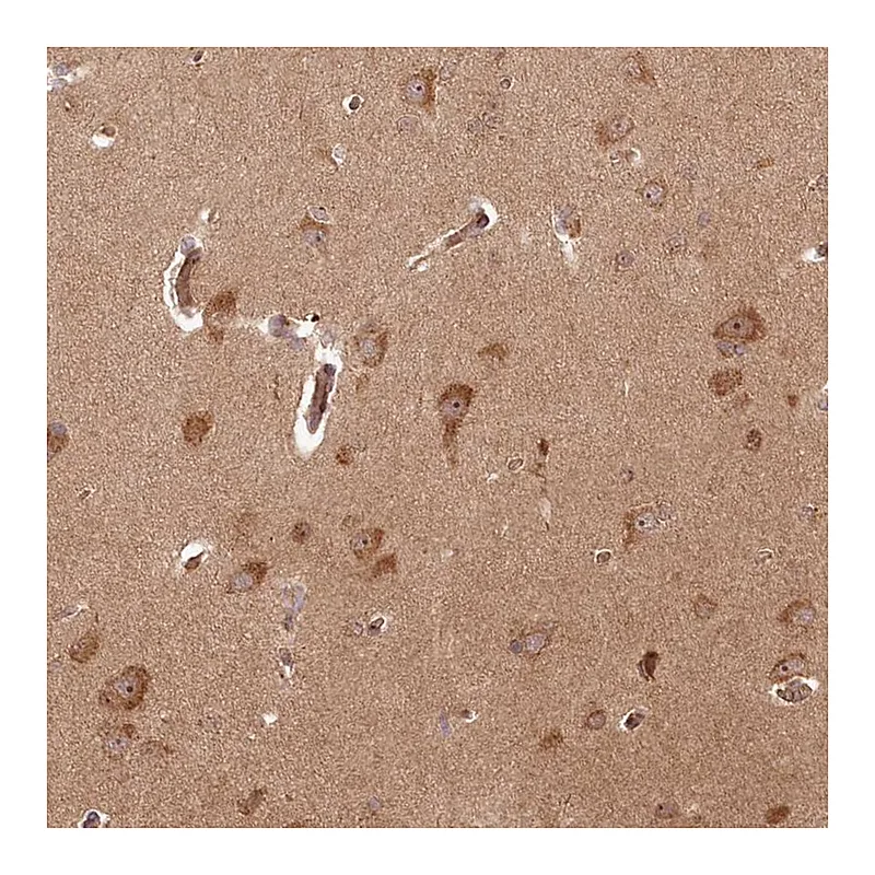 Atlas Antibodies Anti-ARL3 Antibody