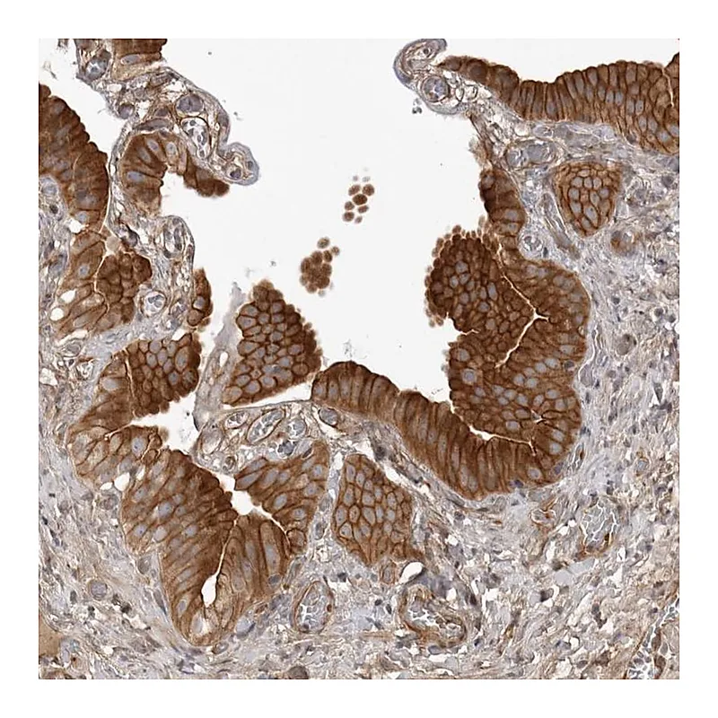 Atlas Antibodies Anti-ARL5A Antibody