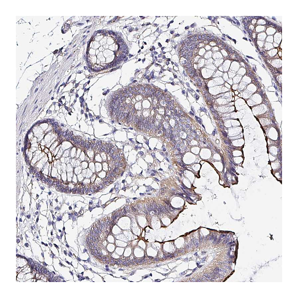 Atlas Antibodies Anti-ARL4D Antibody