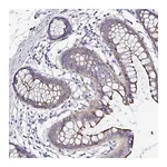 Atlas Antibodies Anti-ARL4D Antibody