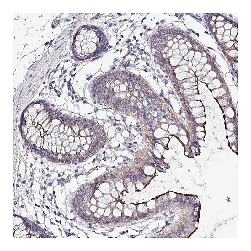 Atlas Antibodies Anti-ARL4D Antibody