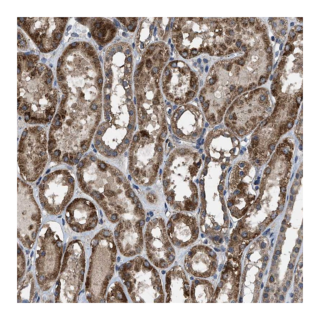 Atlas Antibodies Anti-ARL6 Antibody