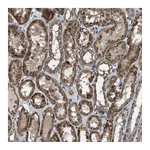 Atlas Antibodies Anti-ARL6 Antibody