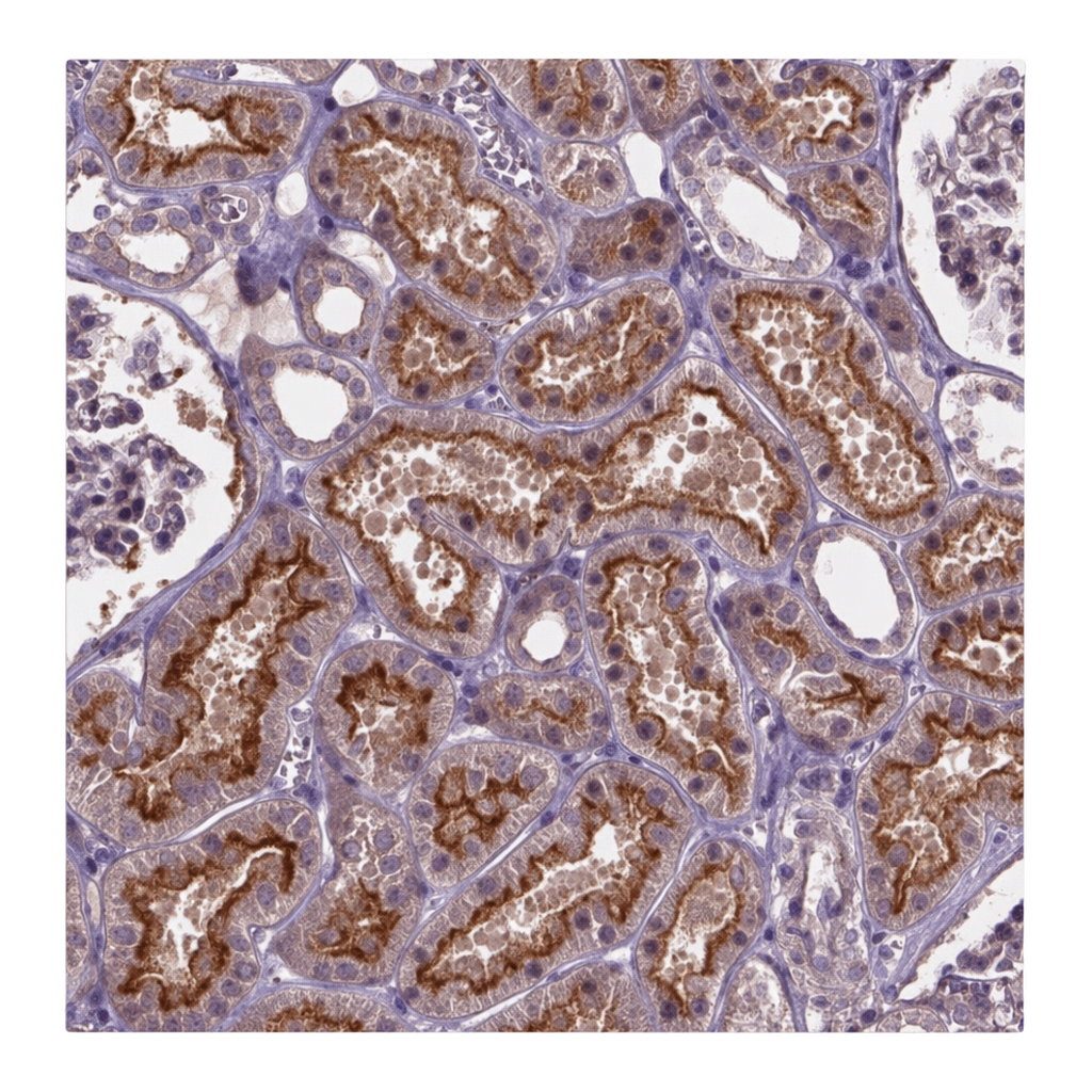Atlas Antibodies Anti-ARL5C Antibody