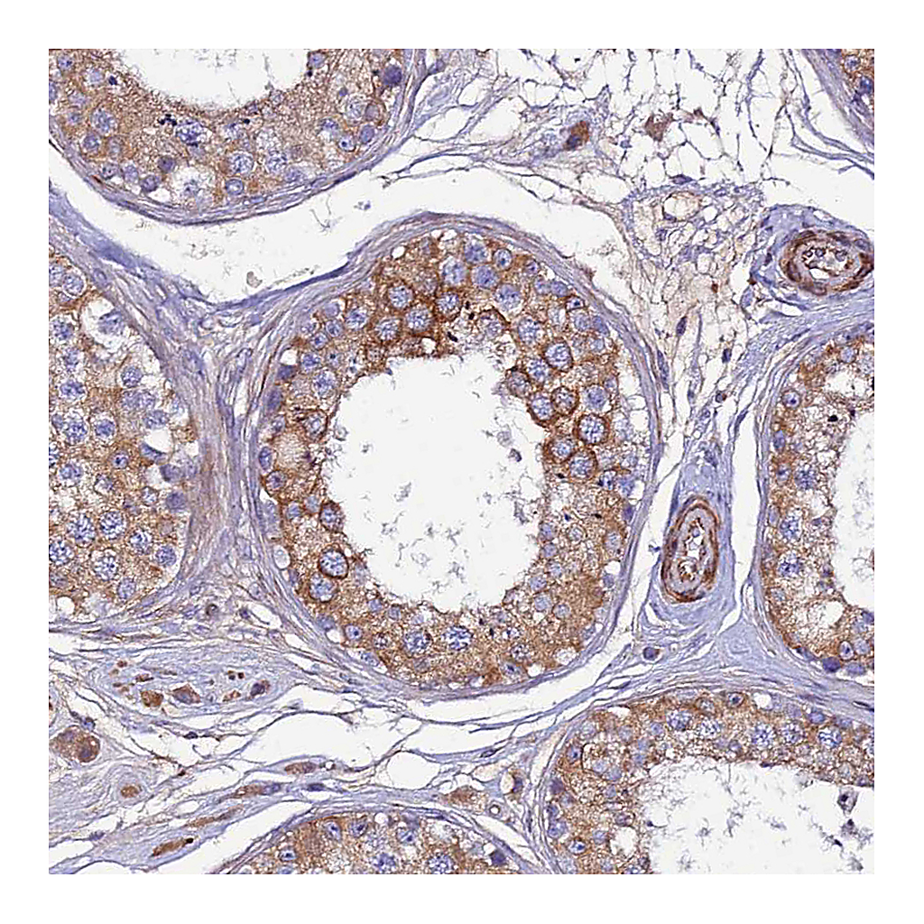 Atlas Antibodies Anti-ARL6IP1 Antibody