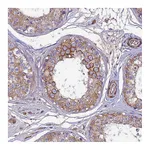Atlas Antibodies Anti-ARL6IP1 Antibody