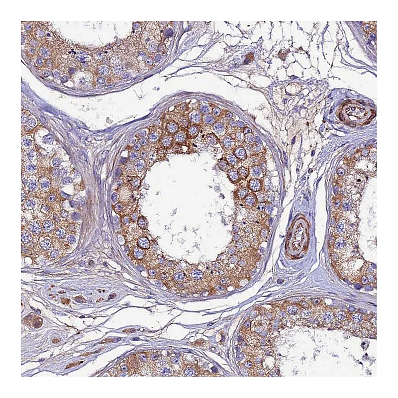 Atlas Antibodies Anti-ARL6IP1 Antibody