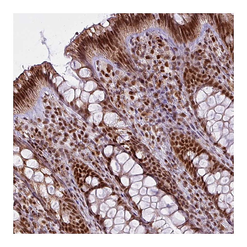 Atlas Antibodies Anti-ARL6IP4 Antibody