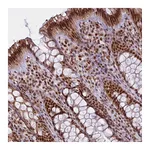 Atlas Antibodies Anti-ARL6IP4 Antibody