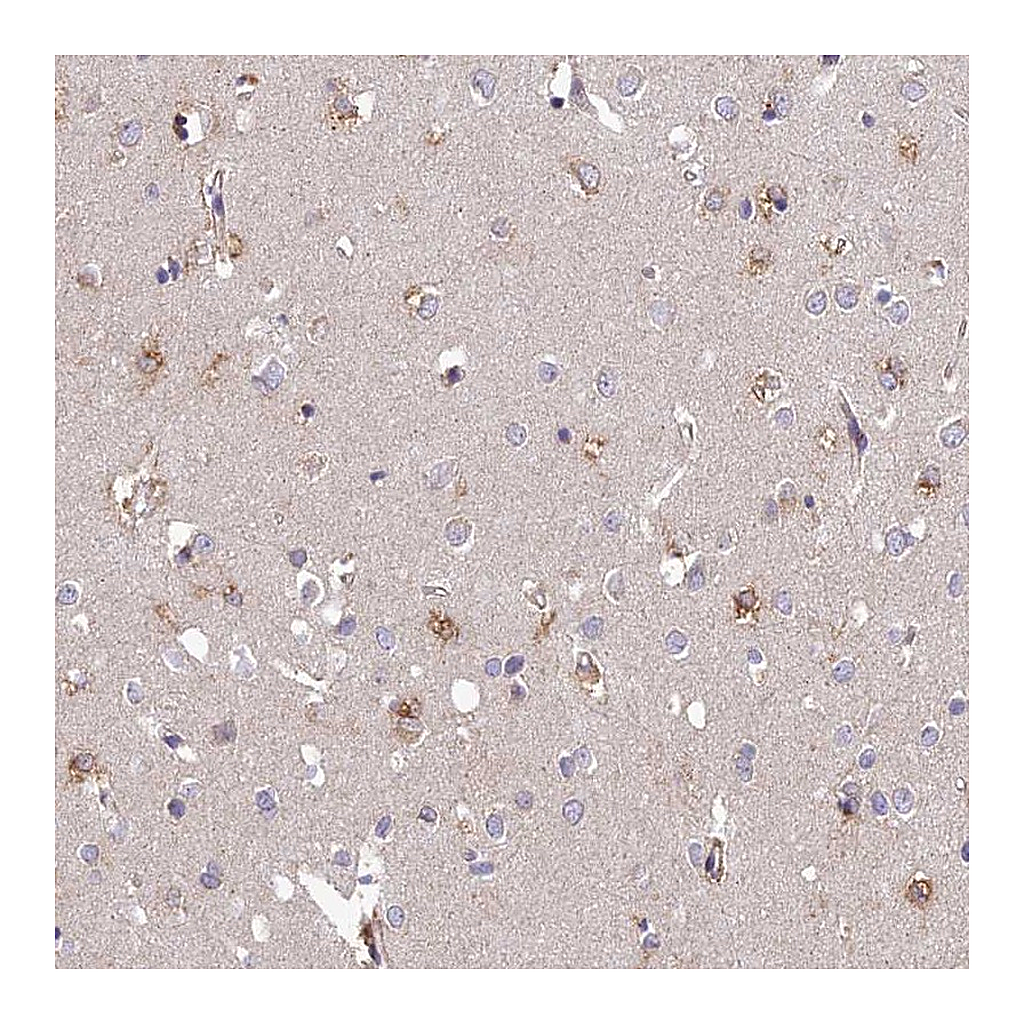 Atlas Antibodies Anti-ARL8A Antibody