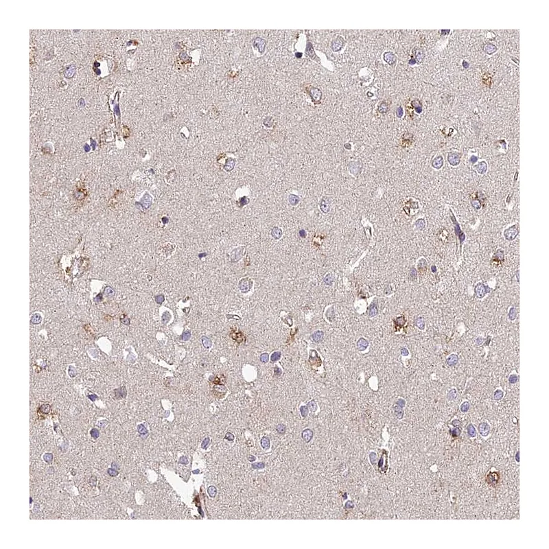 Atlas Antibodies Anti-ARL8A Antibody