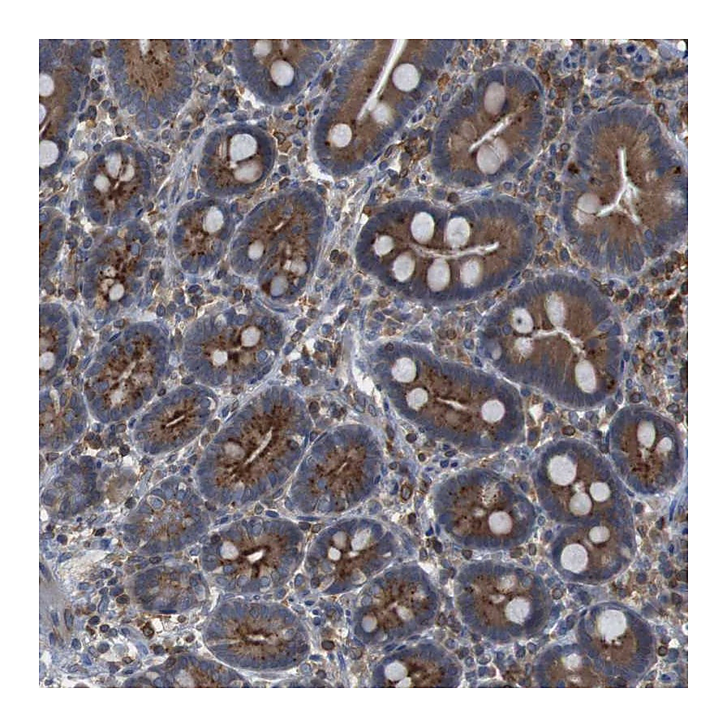 Atlas Antibodies Anti-ARL6IP5 Antibody