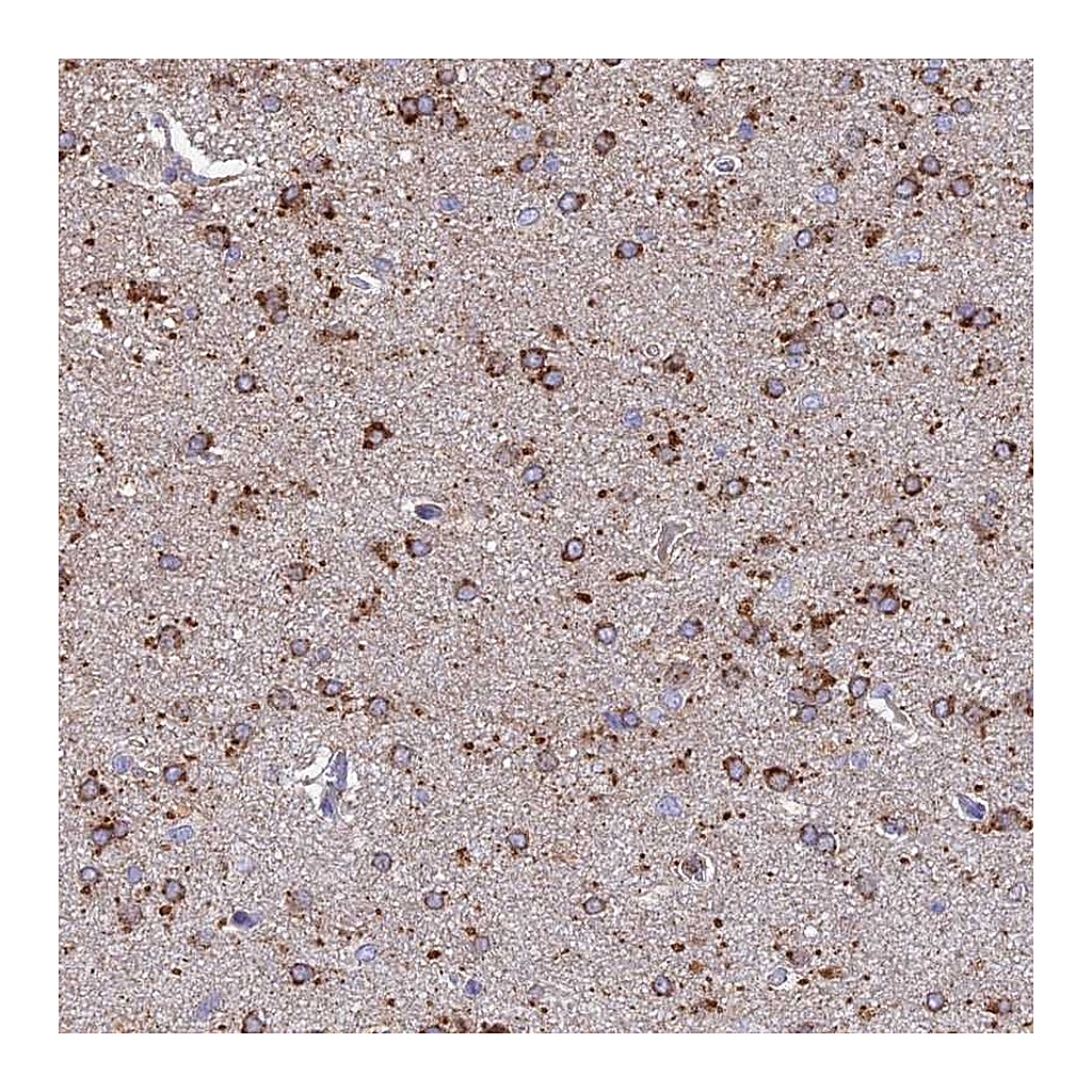Atlas Antibodies Anti-ARL8A Antibody
