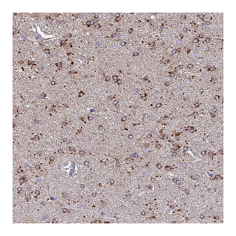 Atlas Antibodies Anti-ARL8A Antibody