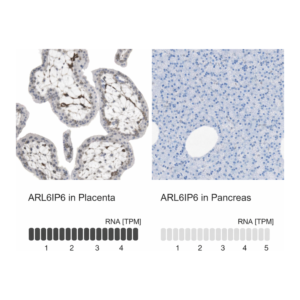 Atlas Antibodies Anti-ARL6IP6 Antibody