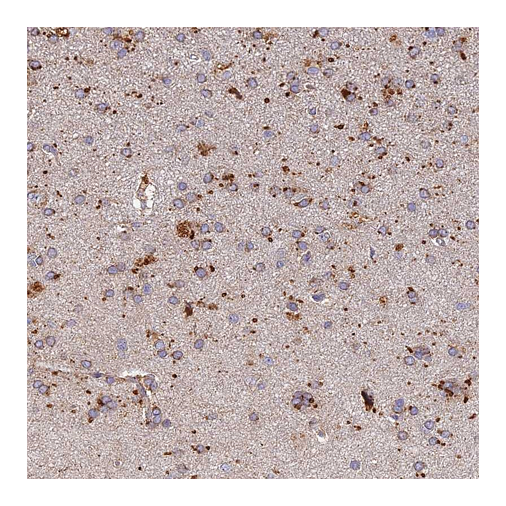 Atlas Antibodies Anti-ARL8A Antibody