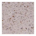 Atlas Antibodies Anti-ARL8A Antibody