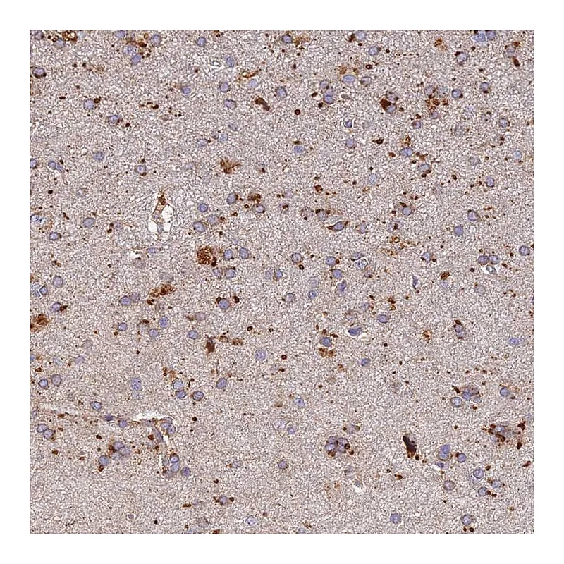 Atlas Antibodies Anti-ARL8A Antibody