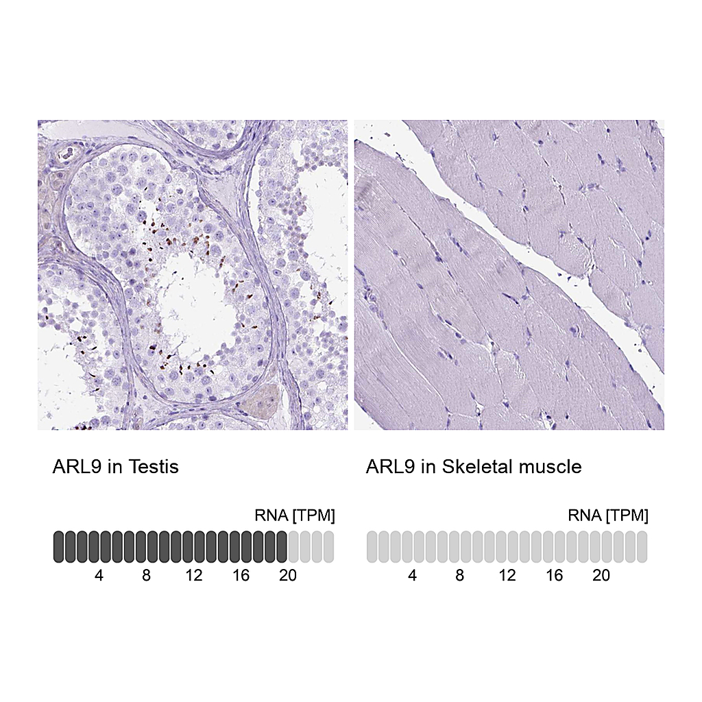 Atlas Antibodies Anti-ARL9 Antibody