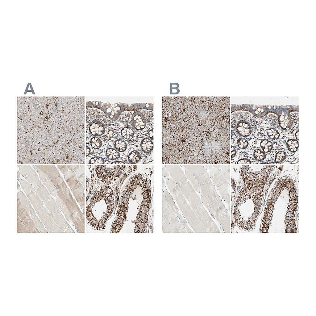 Atlas Antibodies Anti-ARMC10 Antibody