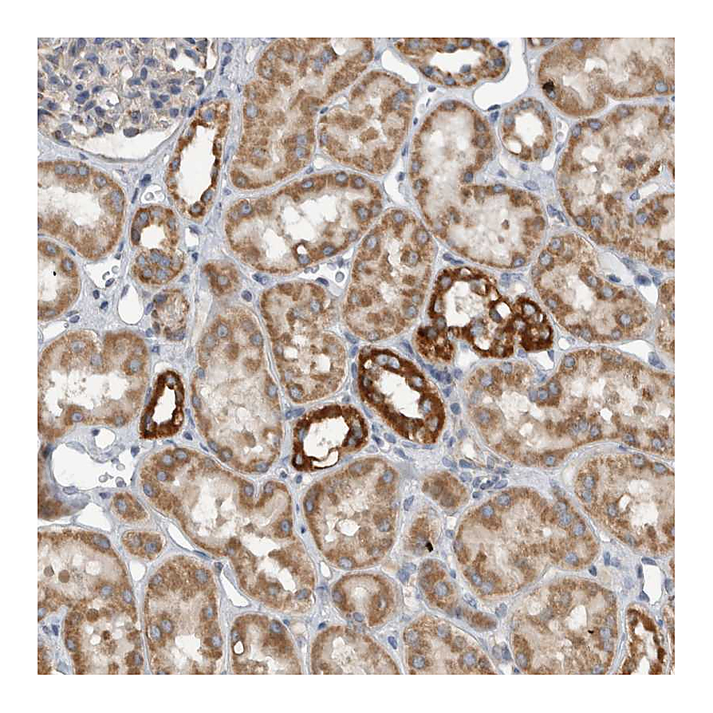 Atlas Antibodies Anti-ARMC1 Antibody