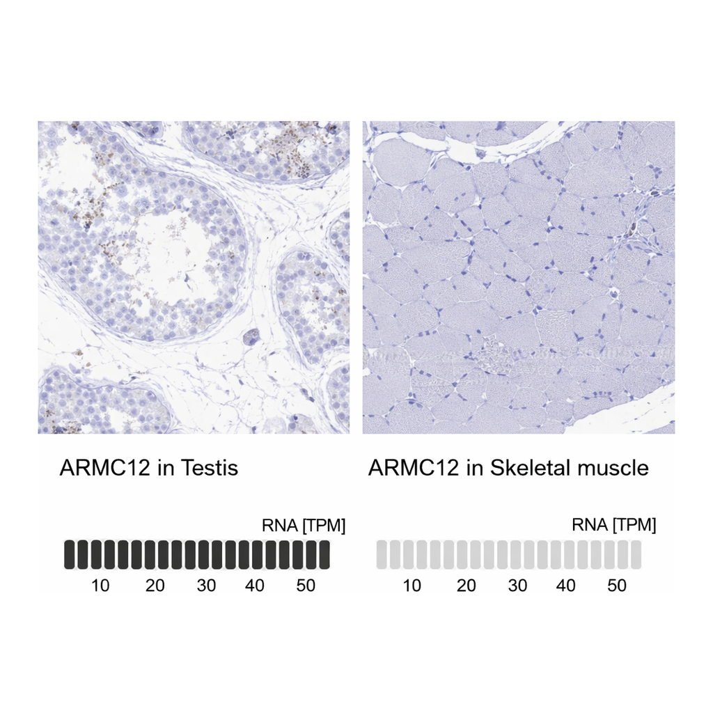 Atlas Antibodies Anti-ARMC12 Antibody
