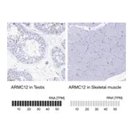Atlas Antibodies Anti-ARMC12 Antibody