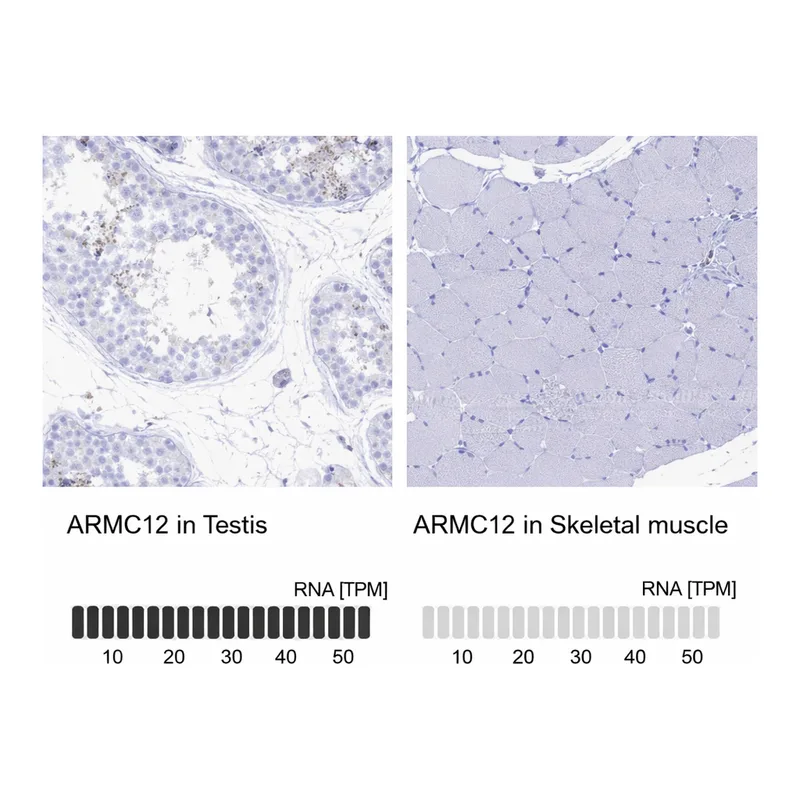 Atlas Antibodies Anti-ARMC12 Antibody