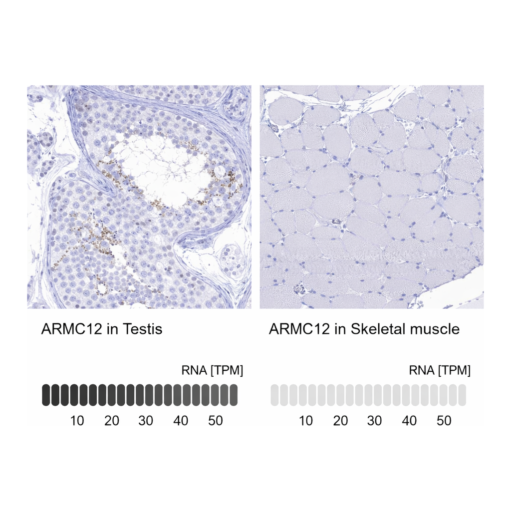 Atlas Antibodies Anti-ARMC12 Antibody