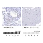 Atlas Antibodies Anti-ARMC12 Antibody