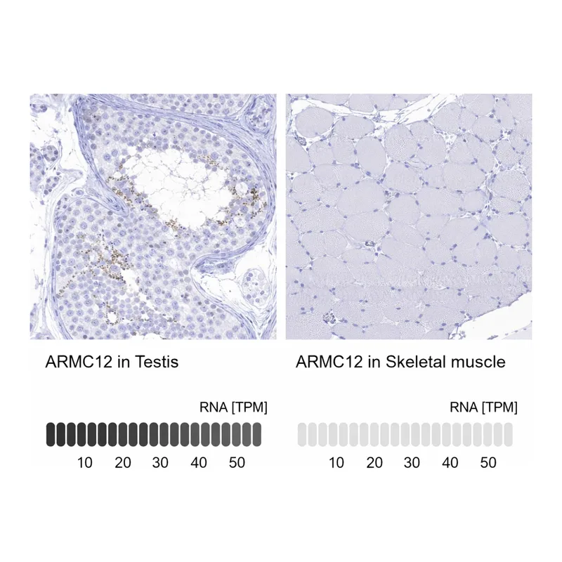 Atlas Antibodies Anti-ARMC12 Antibody