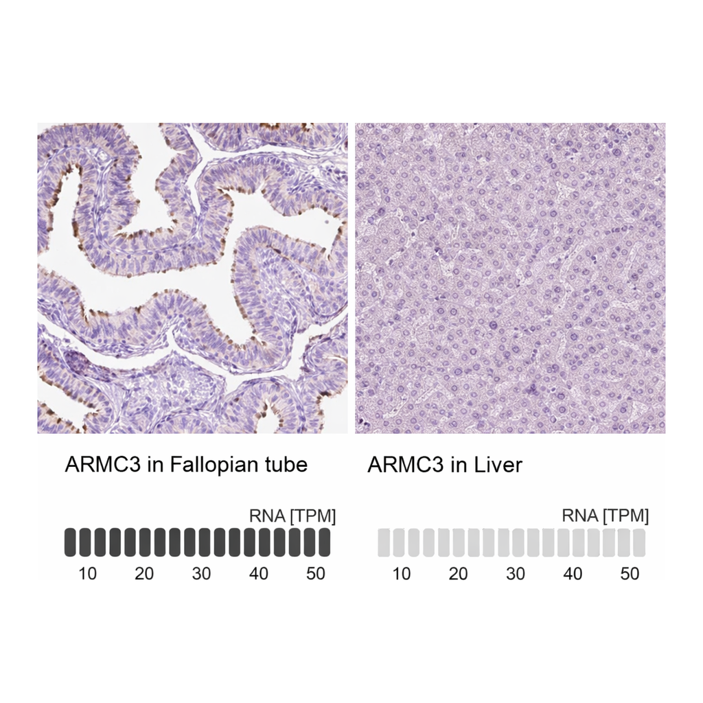Atlas Antibodies Anti-ARMC3 Antibody
