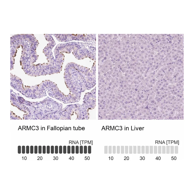 Atlas Antibodies Anti-ARMC3 Antibody