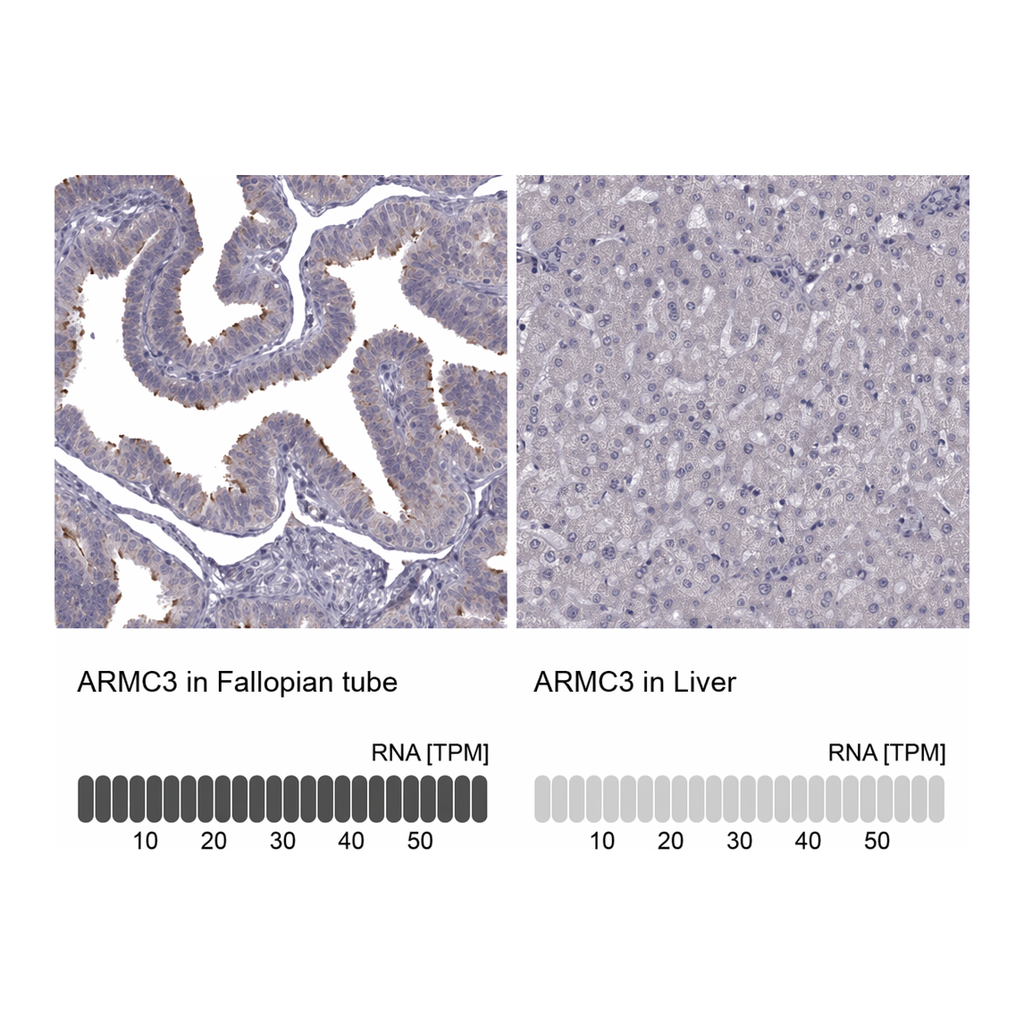 Atlas Antibodies Anti-ARMC3 Antibody