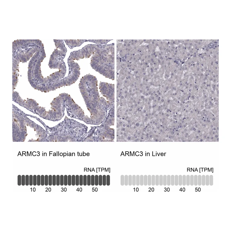 Atlas Antibodies Anti-ARMC3 Antibody