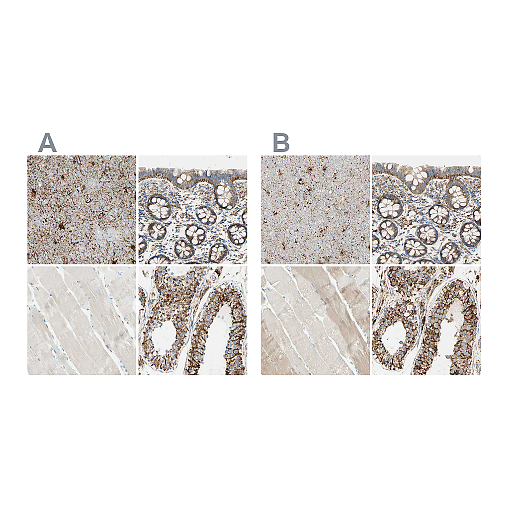 Atlas Antibodies Anti-ARMC10 Antibody