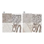 Atlas Antibodies Anti-ARMC10 Antibody