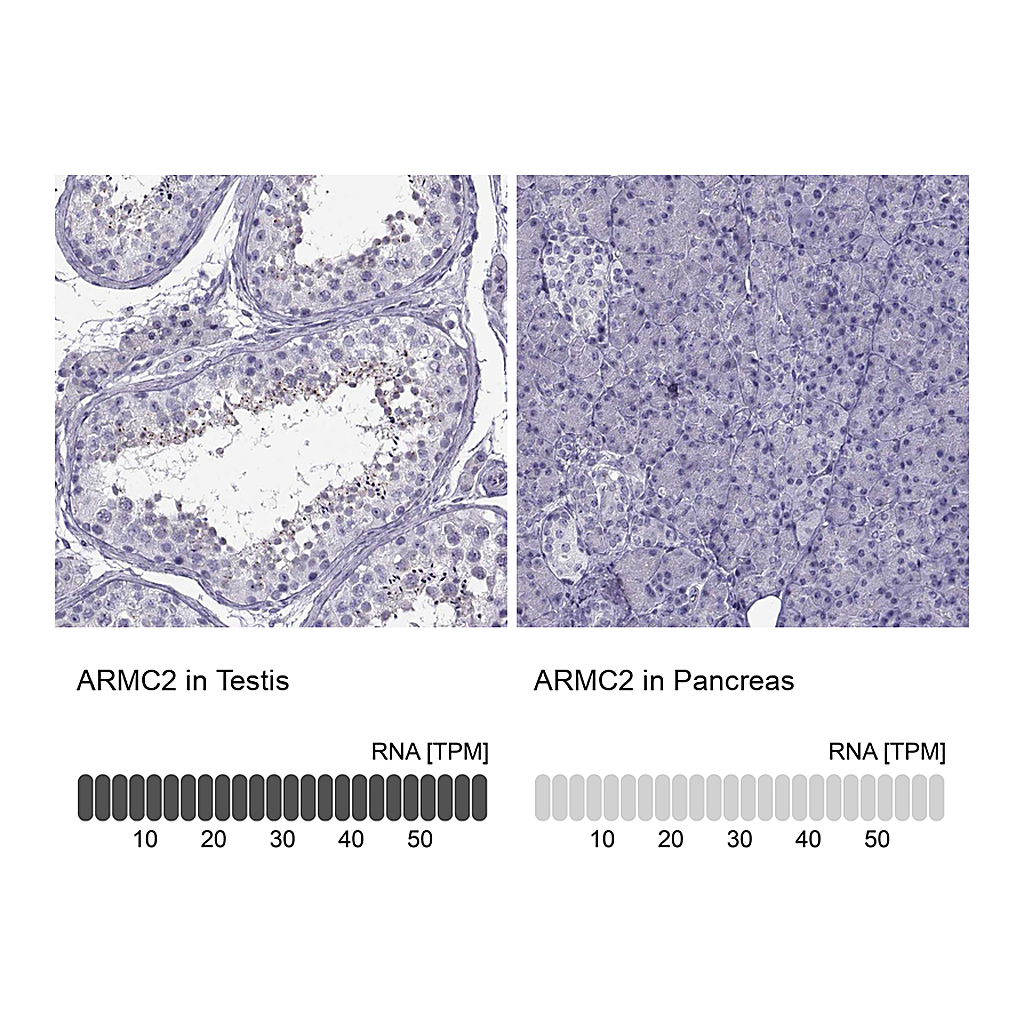 Atlas Antibodies Anti-ARMC2 Antibody