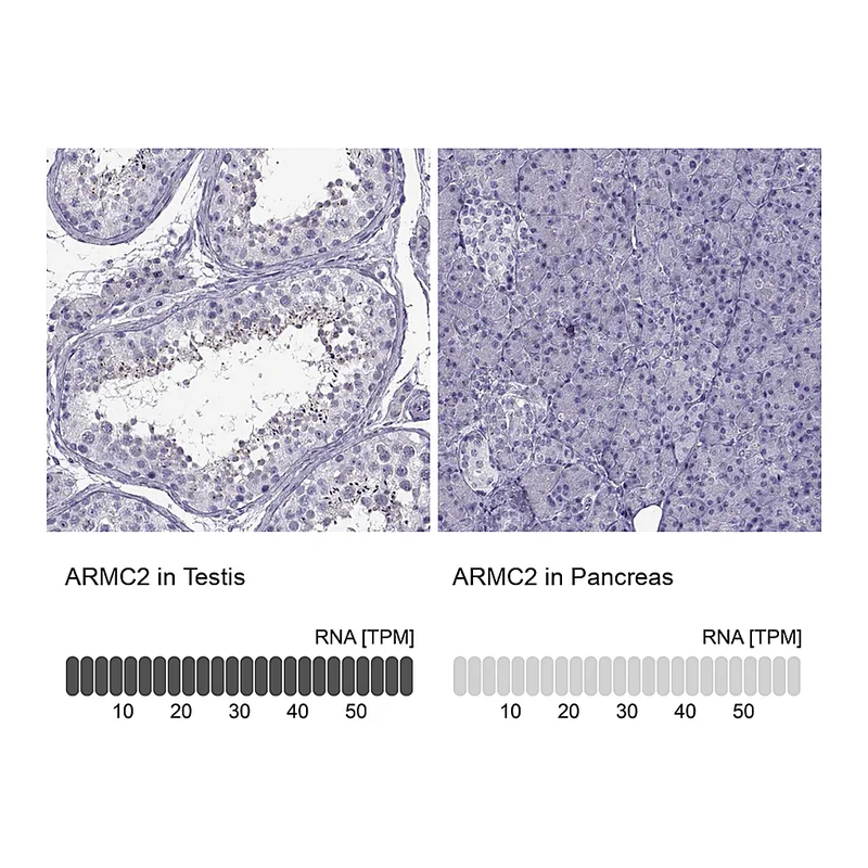 Atlas Antibodies Anti-ARMC2 Antibody