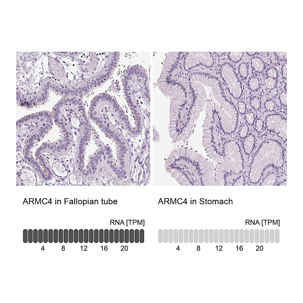 Atlas Antibodies Anti-ARMC4 Antibody